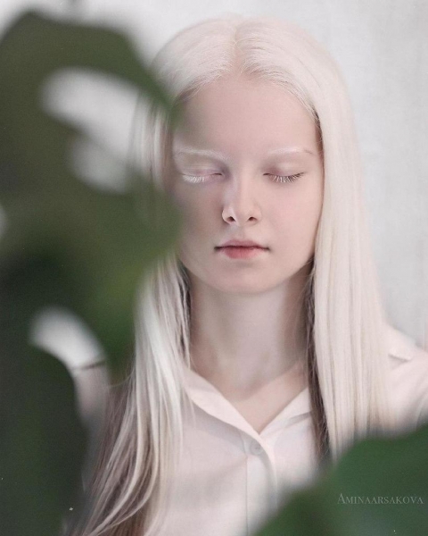 Красота чеченской девочки с альбинизмом и гетерохромией восхитила пользователей сети