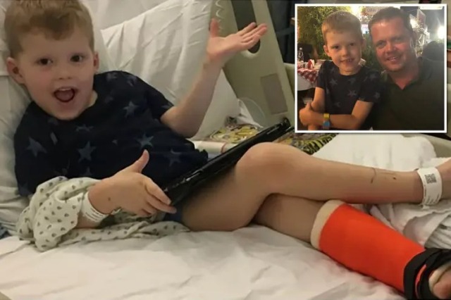 Мальчик, который не чувствует боли, несколько дней ходил на сломанной ноге