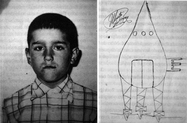 Мальчик из Испании перенес 14 операций после встречи с НЛО в 1977 году