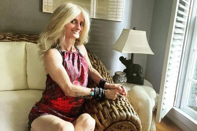 44-летняя жительница Огайо одна из редких долгожителей с прогерией