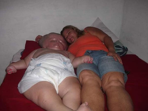 Фото с «гигантским младенцем» напугали Интернет, но правда оказалась куда более жестокой