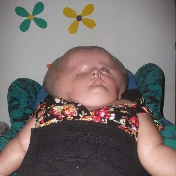 Фото с «гигантским младенцем» напугали Интернет, но правда оказалась куда более жестокой